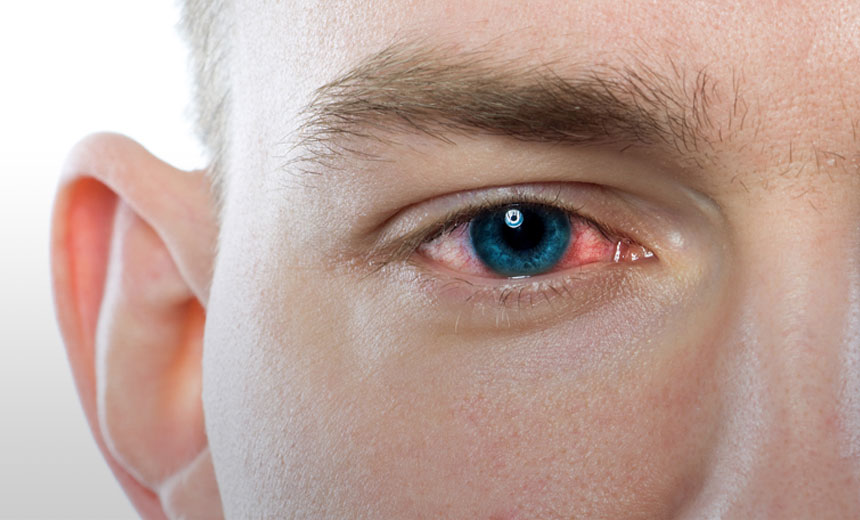 eye-infection - photo by vision eye institute